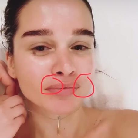 Ксения Бородина губы подколола