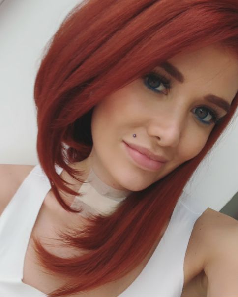 Мы уже писали, что Николь Кузнецова с помощью операции избавилась от трубки в горле!